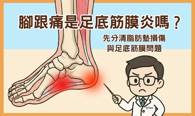 腳跟痛是足底筋膜炎嗎？先分清脂肪墊損傷與足底筋膜問題